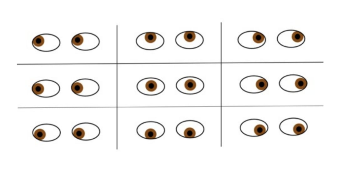 眼球運動検査