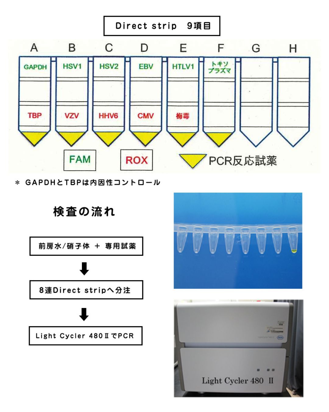 Direct strip検査（strip PCR検査）